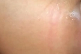 The anus is attracted.
