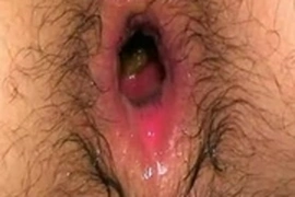 Dirty asian buttholes