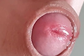 包皮翻開的瞬間